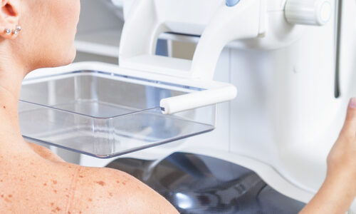 Pijnloos borstonderzoek? LUMC start onderzoek met alternatief mammogram